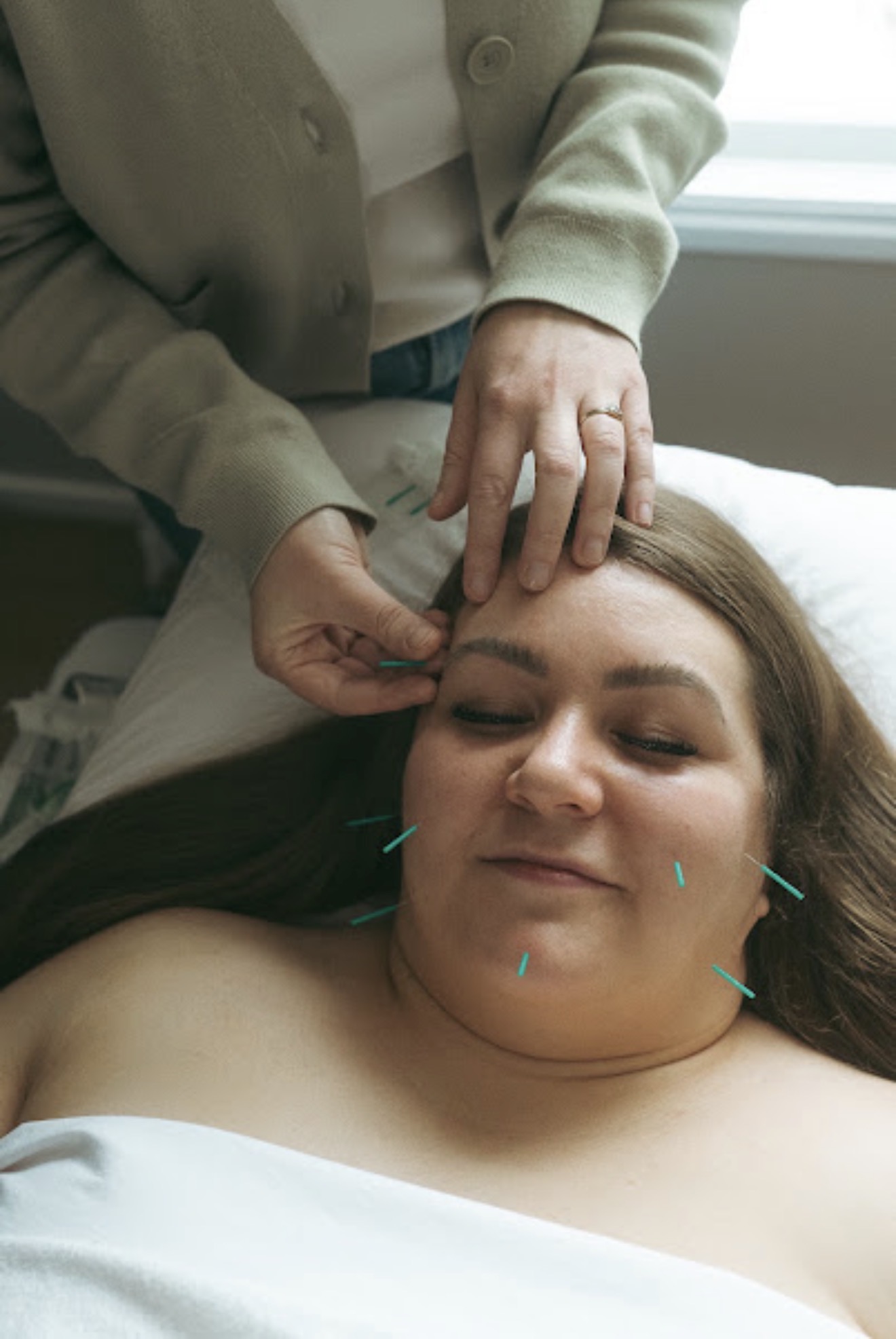 Cosmetic acupuncture treatment with Jada Elexcia